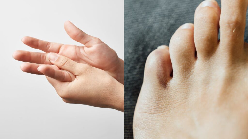 【知恵袋】一本だけ急に指が腫れる時の病気や怪我とすぐできる対処方法 | 知恵袋NOTE