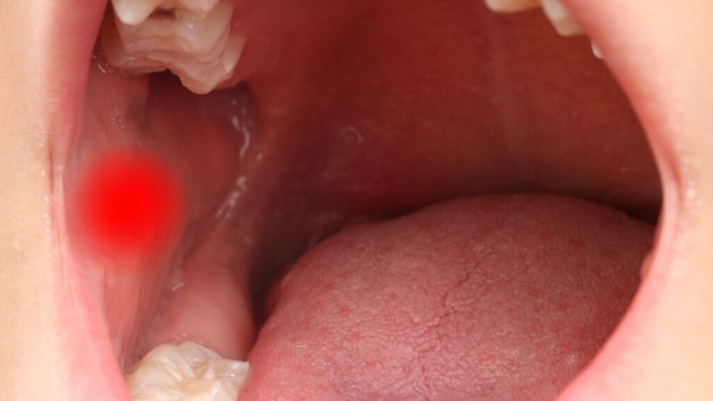 治癒と予防のためのヒント